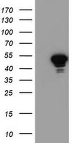 NAPEPLD Antibody in Western Blot (WB)