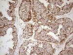 NAPSA Antibody in Immunohistochemistry (Paraffin) (IHC (P))