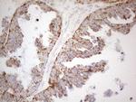 NAPSA Antibody in Immunohistochemistry (Paraffin) (IHC (P))