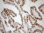 NAPSA Antibody in Immunohistochemistry (Paraffin) (IHC (P))