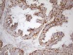 NAPSA Antibody in Immunohistochemistry (Paraffin) (IHC (P))