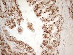 NAPSA Antibody in Immunohistochemistry (Paraffin) (IHC (P))