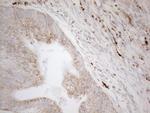 NAPSA Antibody in Immunohistochemistry (Paraffin) (IHC (P))