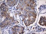 NAPSA Antibody in Immunohistochemistry (Paraffin) (IHC (P))