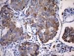 NAPSA Antibody in Immunohistochemistry (Paraffin) (IHC (P))