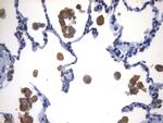 NAPSA Antibody in Immunohistochemistry (Paraffin) (IHC (P))