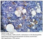 PCSK9 Antibody in Immunohistochemistry (IHC)