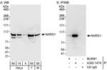 NARG1 Antibody in Western Blot (WB)