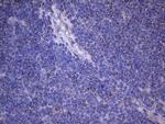 NARS2 Antibody in Immunohistochemistry (Paraffin) (IHC (P))