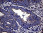 NARS2 Antibody in Immunohistochemistry (Paraffin) (IHC (P))