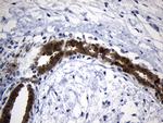 NAT1 Antibody in Immunohistochemistry (Paraffin) (IHC (P))