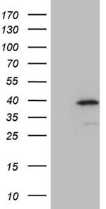 NAT1 Antibody in Western Blot (WB)