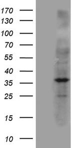 NAT1 Antibody in Western Blot (WB)