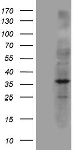 NAT1 Antibody in Western Blot (WB)