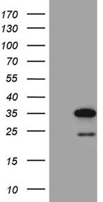 NAT1 Antibody in Western Blot (WB)