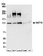 NAT10 Antibody in Western Blot (WB)