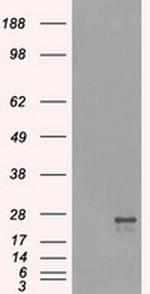 NAT8 Antibody in Western Blot (WB)