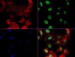 NBN Antibody in Immunocytochemistry (ICC/IF)