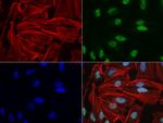 NBN Antibody in Immunocytochemistry (ICC/IF)