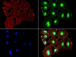 NBN Antibody in Immunocytochemistry (ICC/IF)