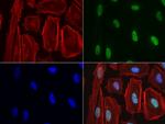 NBN Antibody in Immunocytochemistry (ICC/IF)