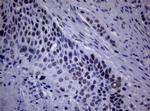 NBN Antibody in Immunohistochemistry (Paraffin) (IHC (P))