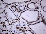 NBN Antibody in Immunohistochemistry (Paraffin) (IHC (P))