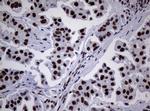 NBN Antibody in Immunohistochemistry (Paraffin) (IHC (P))