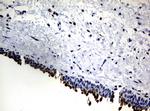 NBN Antibody in Immunohistochemistry (Paraffin) (IHC (P))