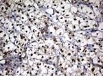 NBN Antibody in Immunohistochemistry (Paraffin) (IHC (P))