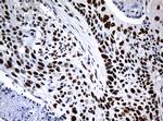 NBN Antibody in Immunohistochemistry (Paraffin) (IHC (P))