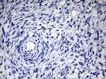 NBN Antibody in Immunohistochemistry (Paraffin) (IHC (P))