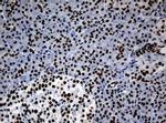 NBN Antibody in Immunohistochemistry (Paraffin) (IHC (P))