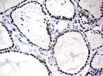 NBN Antibody in Immunohistochemistry (Paraffin) (IHC (P))