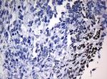 NBN Antibody in Immunohistochemistry (Paraffin) (IHC (P))