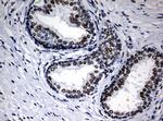 NBN Antibody in Immunohistochemistry (Paraffin) (IHC (P))