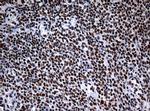 NBN Antibody in Immunohistochemistry (Paraffin) (IHC (P))