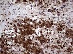 NBN Antibody in Immunohistochemistry (Paraffin) (IHC (P))