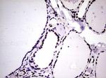 NBN Antibody in Immunohistochemistry (Paraffin) (IHC (P))