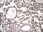 NBN Antibody in Immunohistochemistry (Paraffin) (IHC (P))