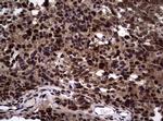 NBN Antibody in Immunohistochemistry (Paraffin) (IHC (P))