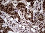 NBN Antibody in Immunohistochemistry (Paraffin) (IHC (P))