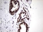 NBN Antibody in Immunohistochemistry (Paraffin) (IHC (P))