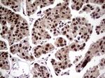 NBN Antibody in Immunohistochemistry (Paraffin) (IHC (P))