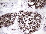 NBN Antibody in Immunohistochemistry (Paraffin) (IHC (P))