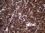 NBN Antibody in Immunohistochemistry (Paraffin) (IHC (P))