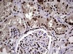 NBN Antibody in Immunohistochemistry (Paraffin) (IHC (P))