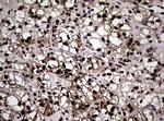 NBN Antibody in Immunohistochemistry (Paraffin) (IHC (P))