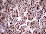 NBN Antibody in Immunohistochemistry (Paraffin) (IHC (P))