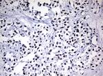 NBN Antibody in Immunohistochemistry (Paraffin) (IHC (P))